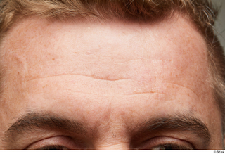 HD Face Skin Steve Q eyebrow face forehead scar skin…